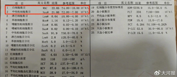 001TnUG6ly4i51yuh8emaj60xc0enq5a02.jpg